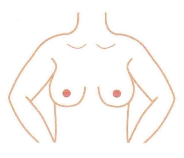 チェック